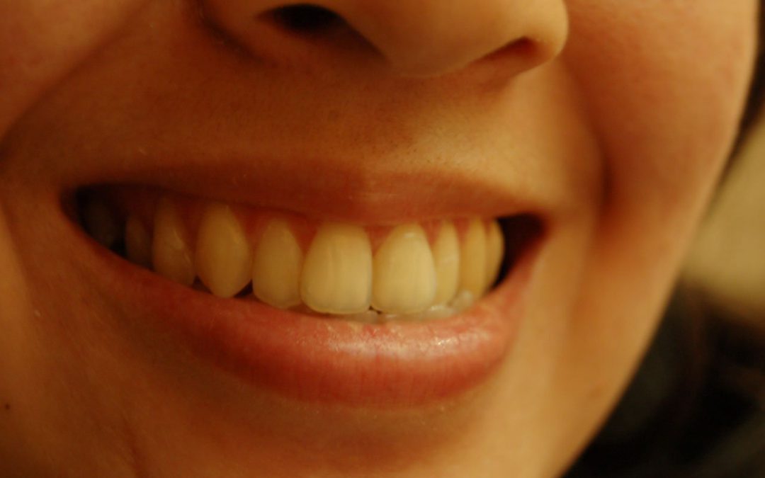 Wypadek-rehabilitacja ciała, a co z utraconymi zębami?